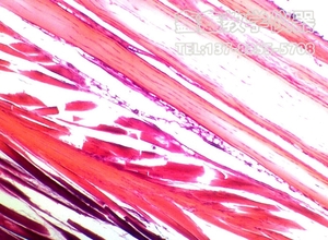 致密结绨组织切片