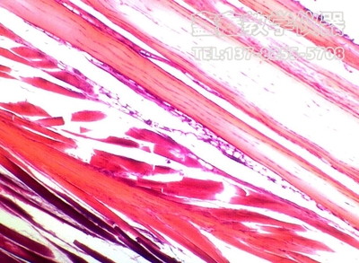 致密结绨组织切片